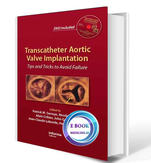 دانلود کتابTranscatheter Aortic Valve Implantation: Tips and Tricks to Avoid Failure  (Original PDF)